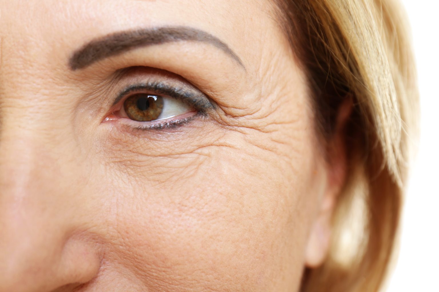 woman-with-wrinkles